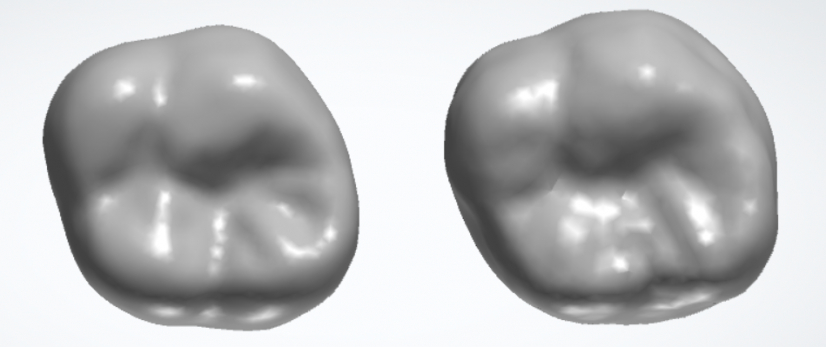 Natural tooth (left) compared with tooth tailored by generative AI  (right)
 